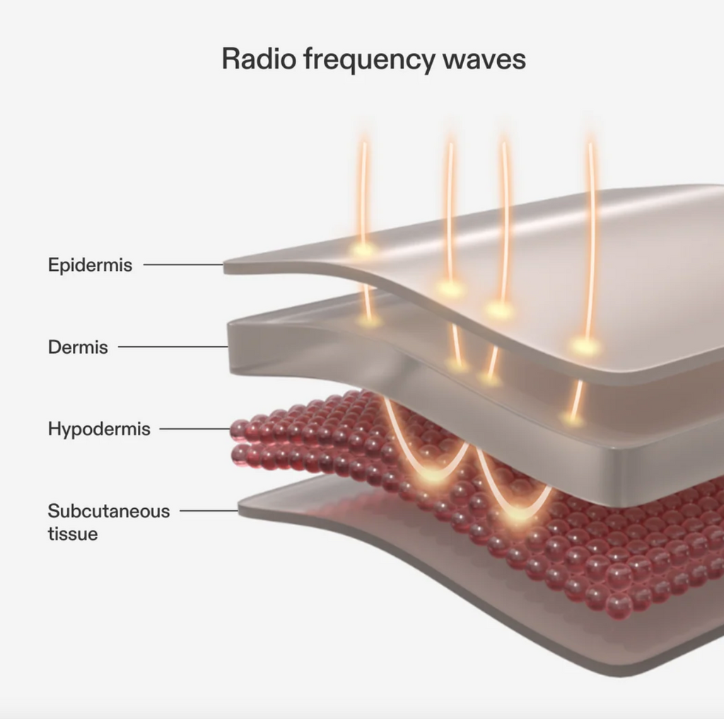CURRENTBODY RF RADIO FREQUENCY SKIN TIGHTENING DEVICE