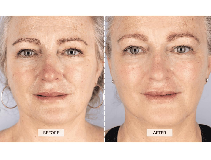 CURRENTBODY LED RED LIGHT THERAPY FACE MASK: SERIES 1